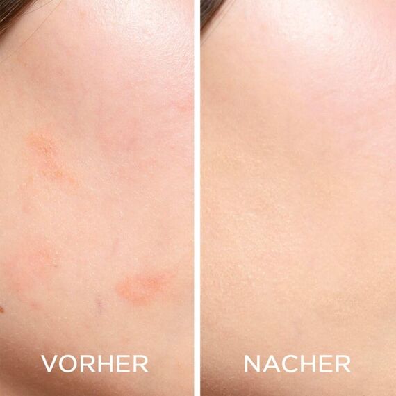 ARTDECO Perfect Teint Concealer - Flüssig Concealer zum Abdecken von Augenringen - 1 x 1,8 ml (Packung mit 2)