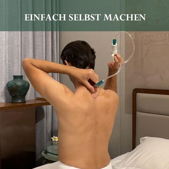 Uplife Schröpfgläser mit Vakuumpumpe - Schröpfset mit 12 Gläsern für Schröpfen & Cupping Therapie - Schröpfgerät & Massage Set Physiotherapie Zubehör - Cupping Set