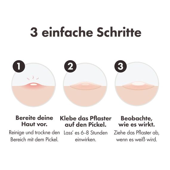 Hero Mighty Patch Original Pickel-Patches von Hero Cosmetics, kleine Hydrokolloid-Pflaster zur Aknebehandlung, 144 Stück