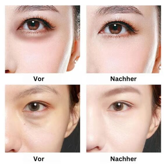 60 Stück Starry Rose Collagen Augenpads – Hydrogel Eye Mask mit Hyaluronsäure & 10 Vitaminen – Anti-Aging Augenpflege gegen Falten, Augenringe & Tränensäcke – Feuchtigkeitsspendende Rosen-Augenmaske