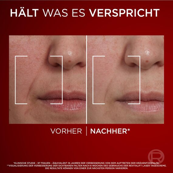 L'Oréal Paris Dreifach-Power Anti-Aging Set, Serum 30 ml und Tagescreme 50 ml, mit 3-fach Wirkung, gegen Falten, mit Pro-Retinol, Hyaluron und Vitamin C, Revitalift Laser, Amazon Exklusiv