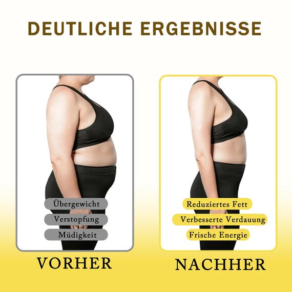Slim Patch zum Abnehmen – Abnehmpflaster für schnelle Fettverbrennung am Bauch – TCM-Kräuter Formel, Anti-Cellulite, Stoffwechsel-Booster, Natürlich & ohne Chemie, 4 Stück