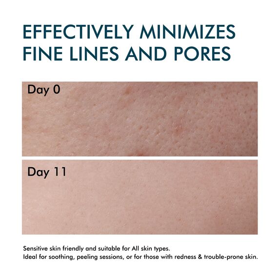 Stammzellen Serum für das Gesicht, Anti-Aging Microneedling Serum, Mildert Hautfalten und Mattheit, Verleiht der Haut neue Ausstrahlung, für alle Hauttypen geeignet, 35 ml