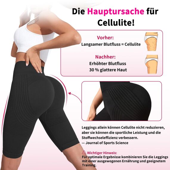 Deedlite Anti Cellulite Leggings 3D Kompression Kurz Damen, Bequeme Kompressionsleggins Lipödem, Push Up Scrunch Für Sport (Kurz, Schwarz, M)