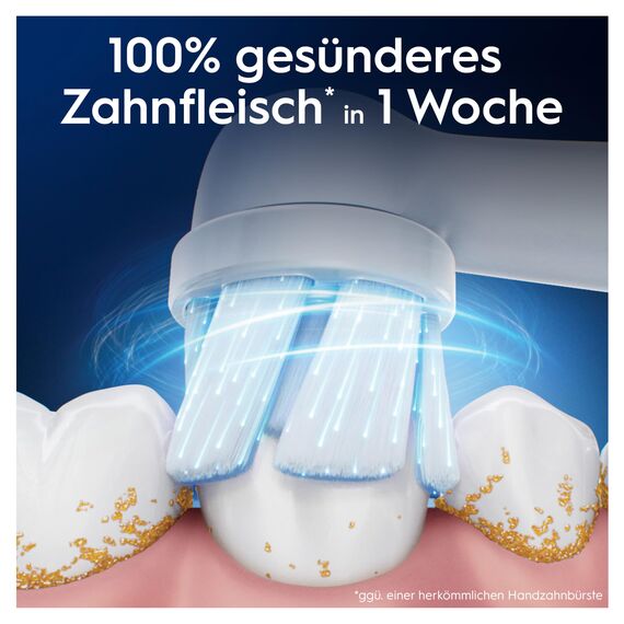 Oral-B iO Sanfte Reinigung Aufsteckbürsten — ORIGINAL Zahnbürstenaufsatz für Elektrische Oral-B iO Zahnbürsten — Ersatzbürsten, Bürstenköpfe für empfindliches Zahnfleisch & Zähne — Weiß, 10 Stück