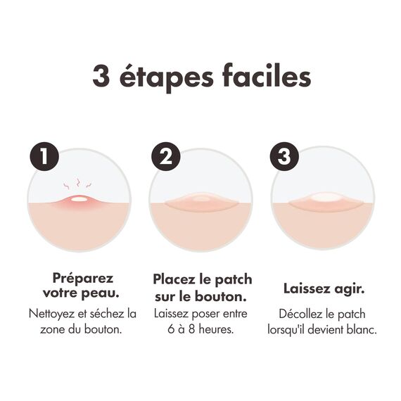 Mighty Patch Original Pickel-Patches von Hero Cosmetics, kleine Hydrokolloid-Pflaster zur Aknebehandlung, 72 Stück (Packung mit 3)