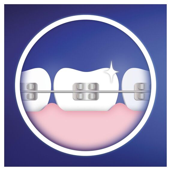 Oral-B Ortho Care Essentials Aufsteckbürsten für elektrische Zahnbürste, 3 Stück, für Zahnspangen, mit extra Interspace Aufsteckbürste