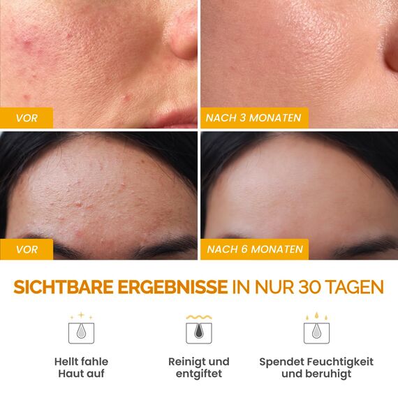 PLANTIFIQUE Koreanische Turmeric Clay Maske mit Vitamin C – Zielt auf dunkle Flecken, verfeinert die Poren, spendet Feuchtigkeit & beruhigt – Inklusive Spatel – Mascarilla de Arcilla con Cúrcuma 110g