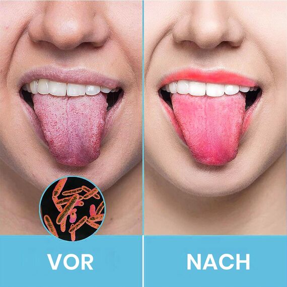 HOKIN Zungenschaber für Erwachsene Zungenreiniger Edelstahl Mundgeruch Bekämpfen 100% Metall Tongue Scraper Cleaner Männer und Frauen Zungenbürste Mundhygiene Produkt (2Pcs Mundpflege Pack)