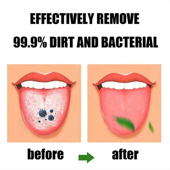Zungenbürste, Zungenschaber, Zungenreiniger, Zungenschaberbürste, Zungenschaberreiniger, Zungenbürsten, Hilft gegen schlechten Atem, 3 Zungenschaber (Schwarz/Blau/Grün)