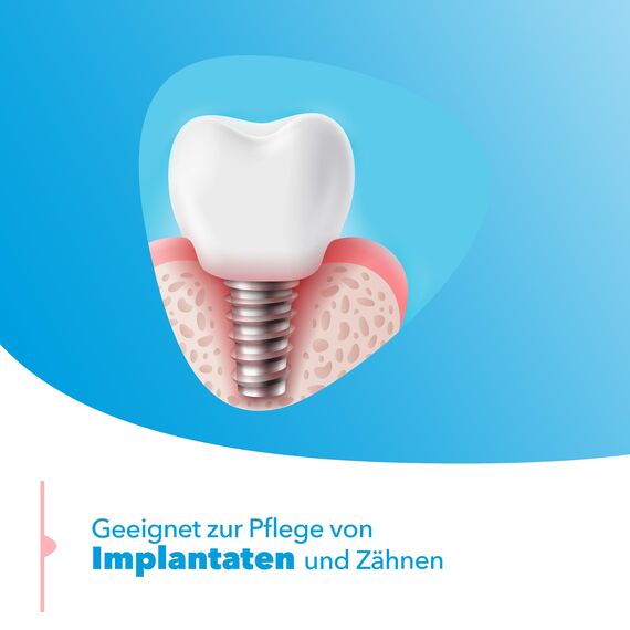 meridol Mundspülung Parodont Expert 400ml - antibakterieller Effekt, hilft die Widerstandskraft des Zahnfleischs gegen die Ursache von Zahnfleischbluten, Parodontitis & Zahnfleischrückgang zu stärken