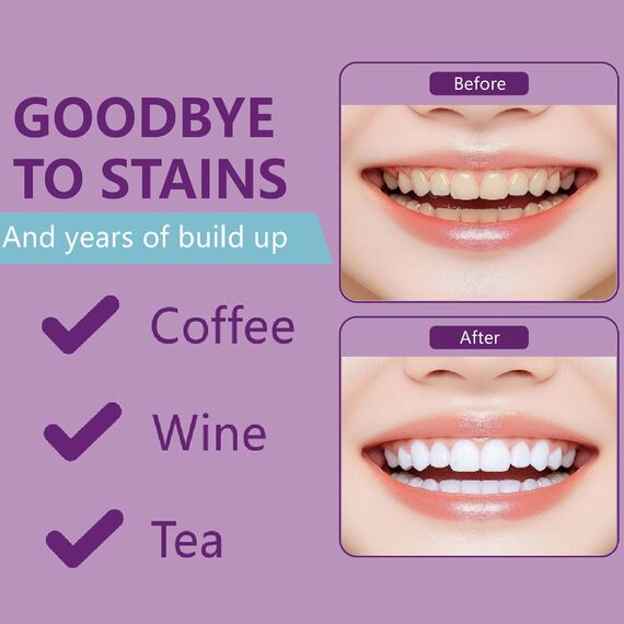 Whitening Strips for Yellow Teeth, Purple Teeth Whitening Strips, Tooth Cleaning Strip, Tooth Stain Remover Strip (2box)