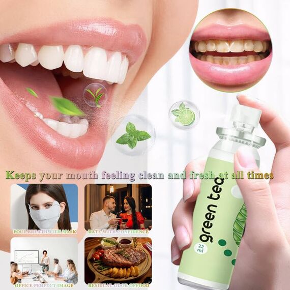 6 Stück Mundspray mit Fruchtgeschmack, Mundspray Gegen Mundgeruch,Tragbar erfrischendes Mundspray,Reduzieren Sie Mundtrockenheit und Halten Sie Den Atem Frisch (22ml)