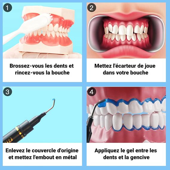 Luckin Smile 10PCS 3ML Zahnfleischschutz-Gel, Zahnfleischschutz-Gel für Zahnaufhellung, geeignet für Zahnarztpraxis, Zahnarzt und Hausgebrauch