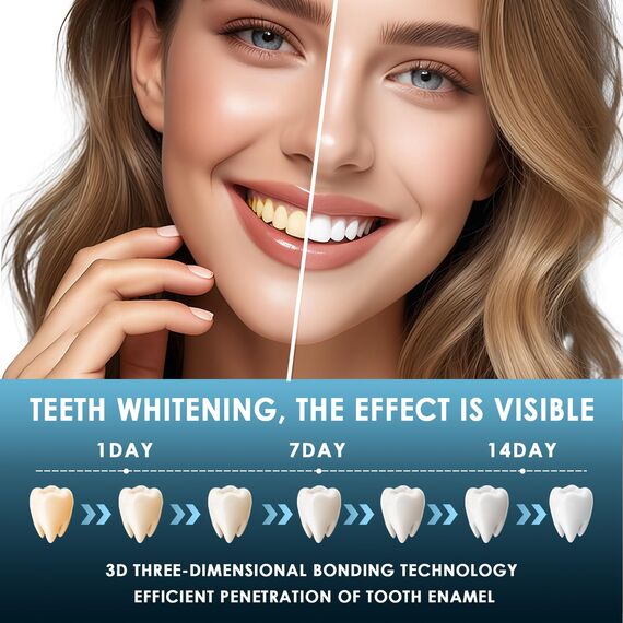 28 Stück Zahnaufhellung Strips,Zahnaufhellung Whitening Strips,Zähne aufhellen white stripes,Professionelle Zahnaufhellungsstreifen,Effektives für Flecken Entfernen,Schwarze Verpackung