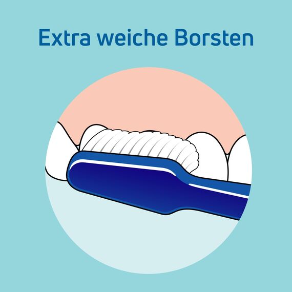 TEPE Mini Zahnbürste mit dem Härtegrad Xsoft, Farblich Sortiert, 1 stück