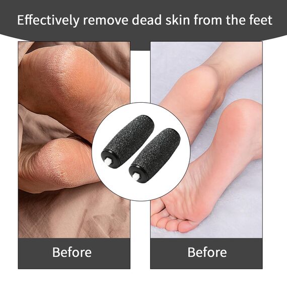 12 Stück Ersatzrollen für Scholl Hornhautentferner, Extra Grobe Nachfüllungen für Elektrische Fußfeile, Kompatibel mit Scholl Velvet Smooth, Pediküre Fußpflege Set zum Entfernen Harter Haut