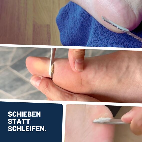 Mr. Fuss No. 4 Advanced Pack Complete, Hornhautentferner, Hornhaut Entfernen Fuß, Fußpflege, Fusspflege, Hornhautentferner Lösung, Fuß Hornhaut Entferner, Nagelhautentferner Flüssig, Anti Hornhaut