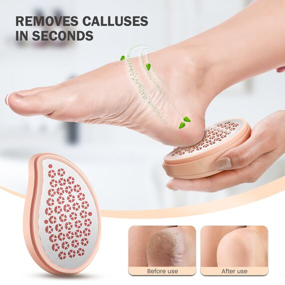 BEZOX 3in1 Nano Glas Hornhautentferner & Edelstahl Hornhautfeile - Hochwirksame Hornhauthobel für samtweiche Füsse - Hornhautraspel Für Hornhautentferner Starke Hornhaut Tote Haut Fuß Schaber