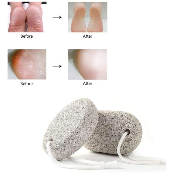 Natürlicher Bimsstein für Füße, 2 Stück, PHOGARY Lava-Pediküre-Werkzeuge, Hornhautentferner für Füße und Hände, natürliches Fußfeilen-Peeling zur Entfernung abgestorbener Haut