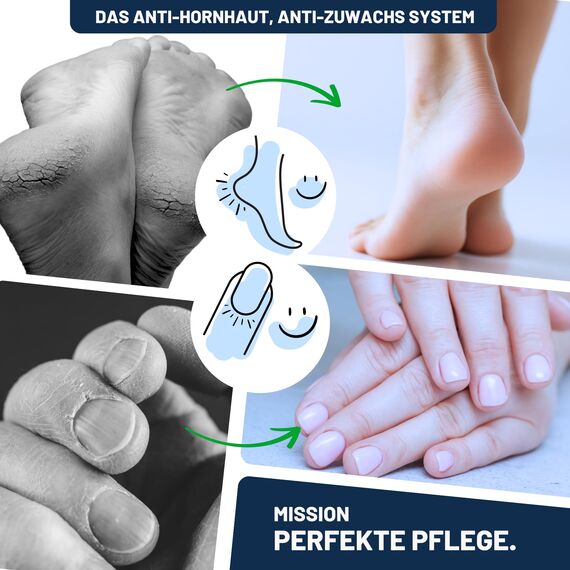 Mr. Fuss No. 4 Advanced Pack Complete, Hornhautentferner, Hornhaut Entfernen Fuß, Fußpflege, Fusspflege, Hornhautentferner Lösung, Fuß Hornhaut Entferner, Nagelhautentferner Flüssig, Anti Hornhaut
