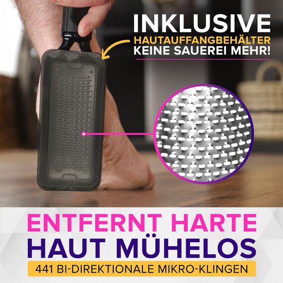 ULTIMATIVE Hornhautfeile Hornhautentferner Für Fußpflege (Groß) MEGAFILE Hornhauthobel Für Hornhaut Entfernen Fuß - Hornhautraspel Für Hornhautentferner Starke Hornhaut Tote Haut Fuß Schaber