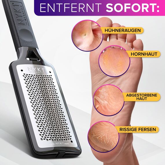ULTIMATIVE Hornhautfeile Hornhautentferner Für Fußpflege (Groß) MEGAFILE Hornhauthobel Für Hornhaut Entfernen Fuß - Hornhautraspel Für Hornhautentferner Starke Hornhaut Tote Haut Fuß Schaber