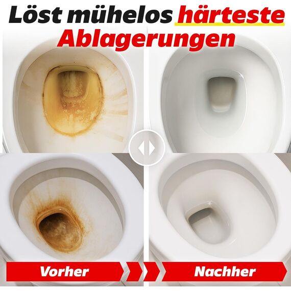 PRINOX 4x Urinsteinentferner EXTRA STARK 1000ml - Profi Urinstein & Kalkentferner Konzentrat - Extrem kraftvoller Urinsteinlöser & WC Reiniger mit Schräghals