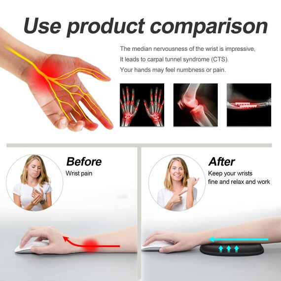 Vaydeer Wrist Rest Pad Ergonomische Ellbogenschützer Gel-Armlehne für Schreibtisch, Armlehnenstütze aus Memory Foam Schaumstoff für Büro, Gaming, Computer, Laptop, Mac – Schwarz