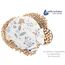 Medi Partners Kirschkernkissen Mikrowelle für Babys 180g rund 15cm Körnerkissen Wärmekissen 100% Baumwolle Öko Natur - Kirschkernkissen Wärme + Kältetherapie Massagetherapie (Reh)