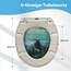 SINOBATH Design WC-Sitz mit Motiv, Soft-Close, Duroplast, Einfache Montage, Quick-Release, UV-beständig