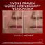L'Oréal Paris Anti-Aging Tagescreme mit Dreichfachpower für Frauen, mit Pro-Retinol, Hyaluronsäure und Vitamin C – gegen Falten, straffende Feuchtigkeitspflege, Revitalift Laser 1 x 50ml