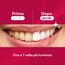 ESMILE – 28 Whitening Strips mit Red Velvet Geschmack – Teeth Whitening Strips für Zahnbleaching Zuhause – 14 Behandlungen